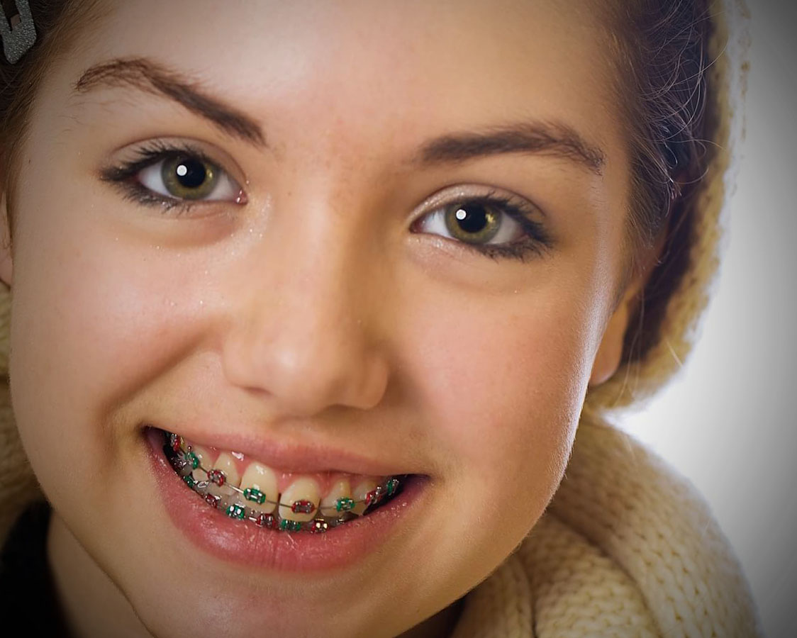 braces-in-dubai 2